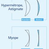 Verre hypermétrope Verre hypermétrope